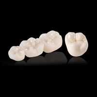 Dental Bridges
